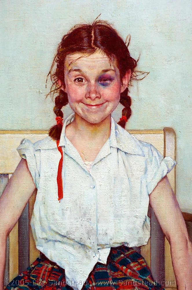 The Young Lady With The Shiner